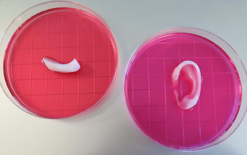 This photo shows a completed ear and jaw bone structures printed with the Integrated Tissue-Organ Printing System. (Credit: Wake Forest Institute for Regenerative Medicine)