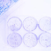 Petri dishes in a lab