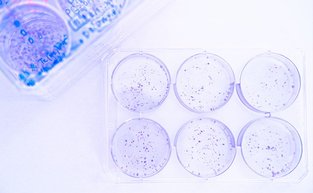 Petri dishes in a lab