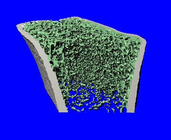 image of bone density scan