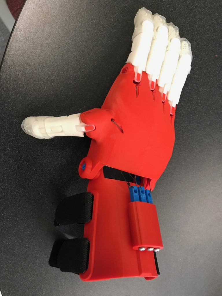 a red and white 3-D printed hand prosthetic