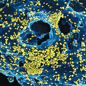 Virus